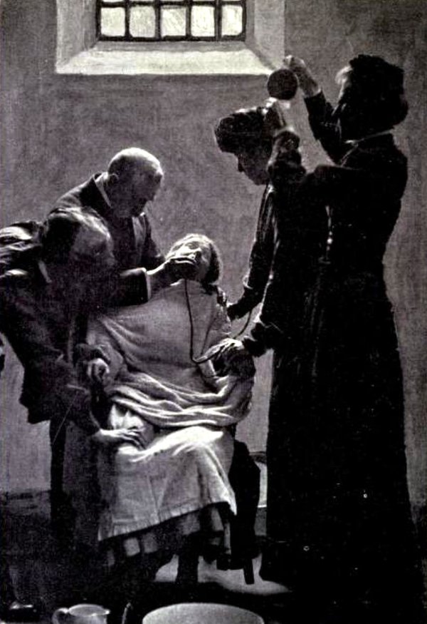 Suffragette nourrie de force en prison (Royaume-Uni, 1911)